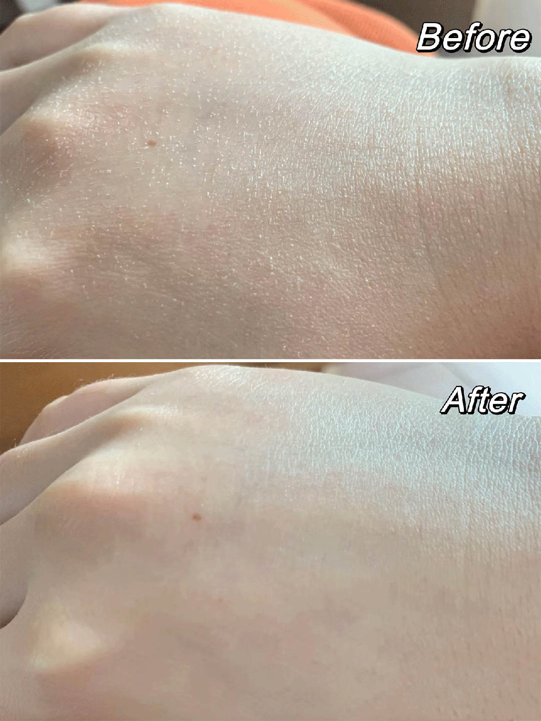 试这个外抹的方子一试就灵不朽情缘手足干裂的人试(图5)