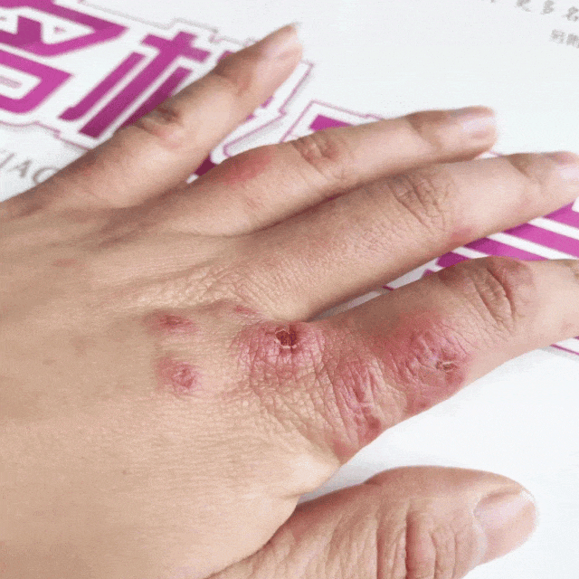 试这个外抹的方子一试就灵不朽情缘手足干裂的人试(图14)