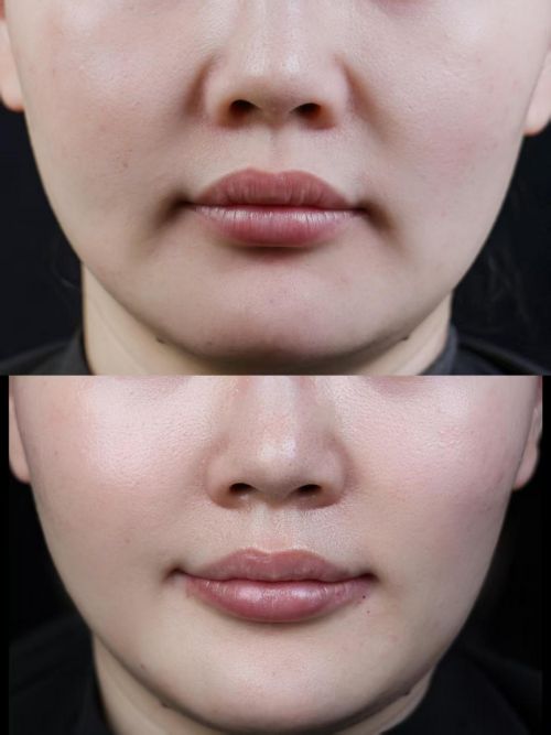 榜前十名公认有效的抗皱产品汇总分析不朽情缘app抗衰老的护肤品排行(图1)